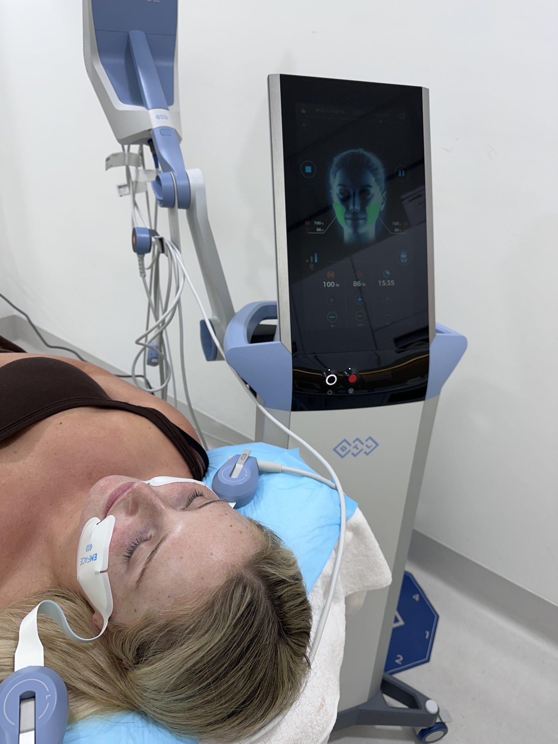 Riley Hemson bridal skin preparation Gold Coast natural glowing skin